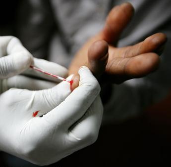 milyen tünetekkel lehet felismerni a HIV AIDS-et 